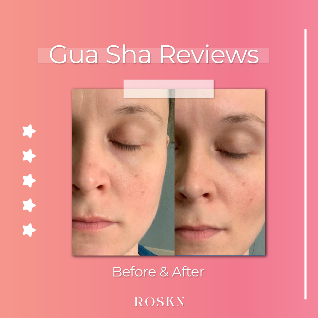 Gua-Sha | جواشا